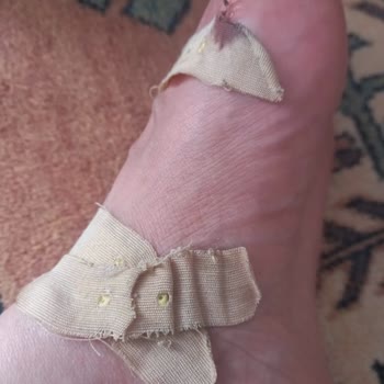 Ayak Kesici Terlik İçin İade Reddi Ve Sağlık Şikayeti