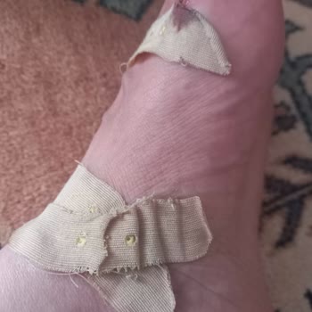 Ayak Kesici Terlik İçin İade Reddi Ve Sağlık Şikayeti