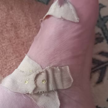 Ayak Kesici Terlik İçin İade Reddi Ve Sağlık Şikayeti