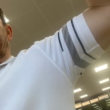 Lacoste Tişörtündeki Şeritlerin Erken Dökülmesi Ve Değişim Talebi