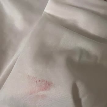 Kullanılmış Ve Kötü Kokulu Elbise Gönderildi, İade İşlemi Zorlaştı
