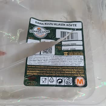 Migros Köfte İçinde Taş Parçalar Ve Diş Hasarı