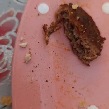 Migros Köfte İçinde Taş Parçalar Ve Diş Hasarı