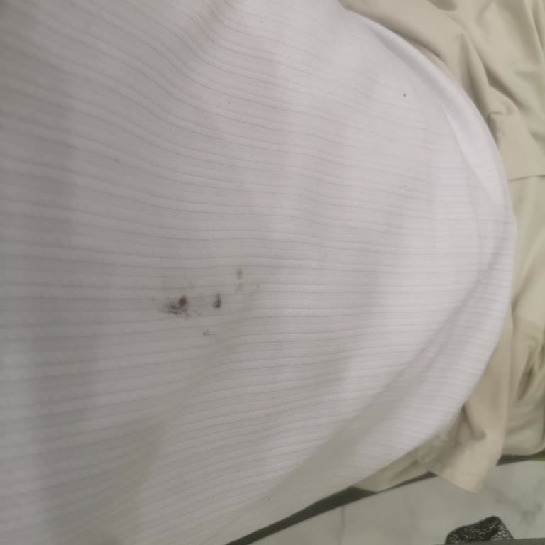 Kalın Tütün Dalları Ve Yangın Tehlikesi Nedeniyle Kıyafetler Yanıyor