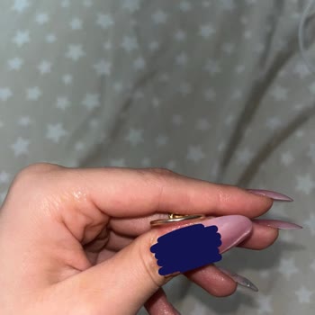 Pandora Ankamall’da Renk Değişen Yüzük Ve Cevapsız Yetkili