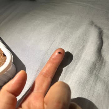 Alpedo Dondurmasında Sert Taş: Diş Ve Boğaz Riski