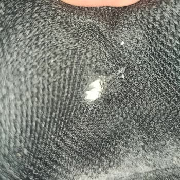 Skechers Ayakkabısında Bir Ayda İç Yırtık Ve Mağaza Kullanıcı Hatası İddiası