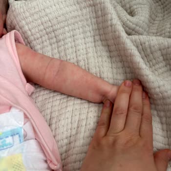 Mustela Stelatopia Kreminde Bebek Cildinde Şiddetli Kızarıklık Ve İade Talebi
