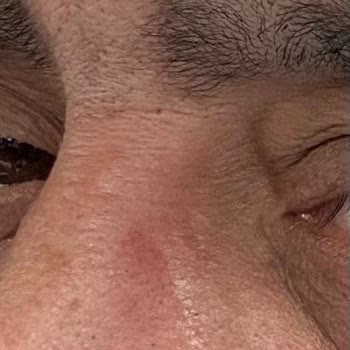 Rayban Ağır Gözlük Burunda İz Bırakıyor