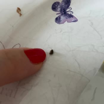 Antepsan Fıstık Kremasında Yabancı Madde Çıktı Ve Dişim Kırıldı