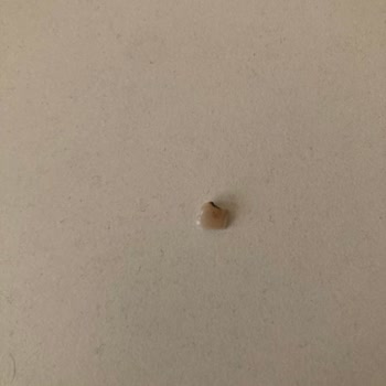 Eti Granola’da Sert Parça Dişi Kırdı Ve Maddi Zarar Verdi