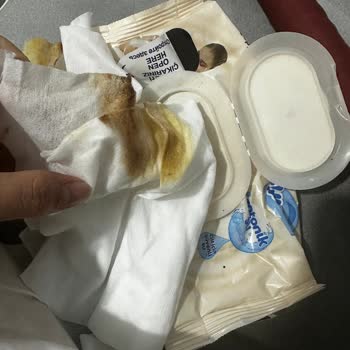 Molfix Yenidoğan Islak Mendilde Anahtarlık Parçası Ve Küflü Mendiller Bebeği Pişik Yaptı