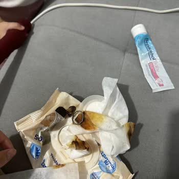 Molfix Yenidoğan Islak Mendilde Anahtarlık Parçası Ve Küflü Mendiller Bebeği Pişik Yaptı