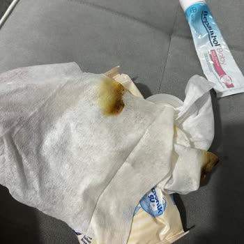 Molfix Yenidoğan Islak Mendilde Anahtarlık Parçası Ve Küflü Mendiller Bebeği Pişik Yaptı