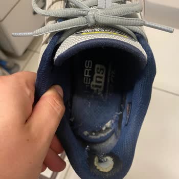 Skechers Ayakkabısında Erken Yırtılma: İade Ve Değişim Talebi