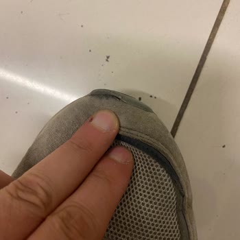 Skechers Ayakkabısında Erken Yırtılma: İade Ve Değişim Talebi