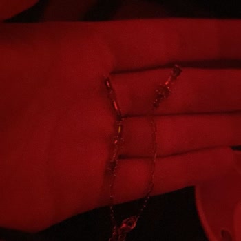 Sürekli Kırılan So Chic Bileklik İçin Kalıcı Çözüm Talebi
