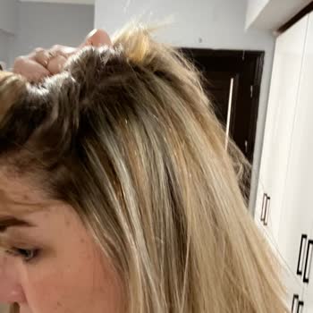 Röfle Ve Fön İşlemlerinde Turuncu Renk Hatası Ve Yanma Sorunu
