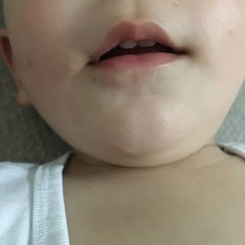 Bademli Çikolata Etiket Hatası Çocuğumun Alerjisini Tetikledi