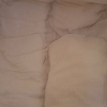Bebek Bezinde Yabancı Kirpik Bulunması Hijyen Ve Güven Endişesi