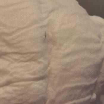 Bebek Bezinde Yabancı Kirpik Bulunması Hijyen Ve Güven Endişesi