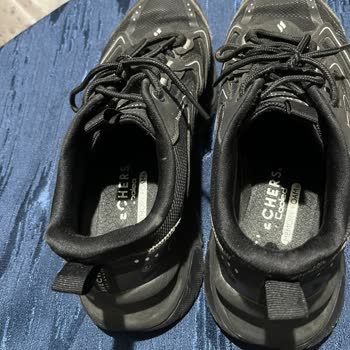 Skechers Ayakkabısındaki Ayak Tahrişi Ve Mağaza Çözüm Sunmaması