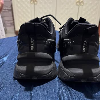 Skechers Ayakkabısındaki Ayak Tahrişi Ve Mağaza Çözüm Sunmaması