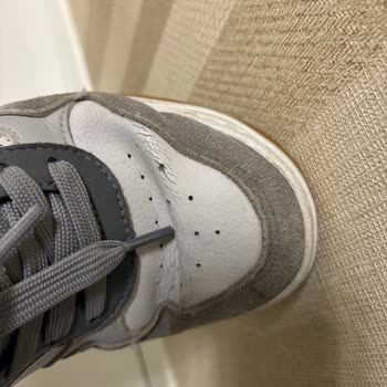 Üç Ayda Deforme Olan Skechers Ayakkabısına İade Reddi