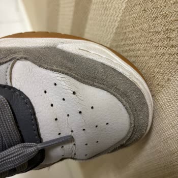Üç Ayda Deforme Olan Skechers Ayakkabısına İade Reddi