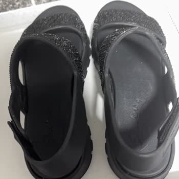 Skechers Sandaleti Üst Kısmının Sertliği Ayak Parmaklarına Kesik Verdi
