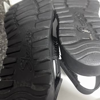 Skechers Sandaleti Üst Kısmının Sertliği Ayak Parmaklarına Kesik Verdi