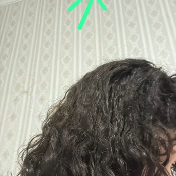 Kuaför Göksel Kahraman Saçım Yanarak Küllere Dönüştü, Kuaför 4.000 TL Ücret İstedi