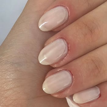 Talas Elizi Kuaförü Manikürde Kesilen Tırnak Etleri Ve Saygısız Geri Dönüş