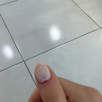Talas Elizi Kuaförü Manikürde Kesilen Tırnak Etleri Ve Saygısız Geri Dönüş