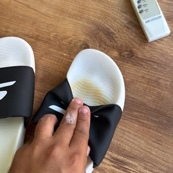 Skechers Hyper Slide Terliğinin Hızlı Sararması Ve İade Reddi