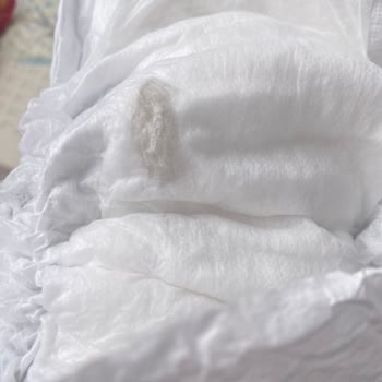 Bebek Bezinde Yabancı Madde: Üretim Hatası Ve Yetersiz Açıklama