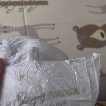 Bebek Bezinde Yabancı Madde: Üretim Hatası Ve Yetersiz Açıklama
