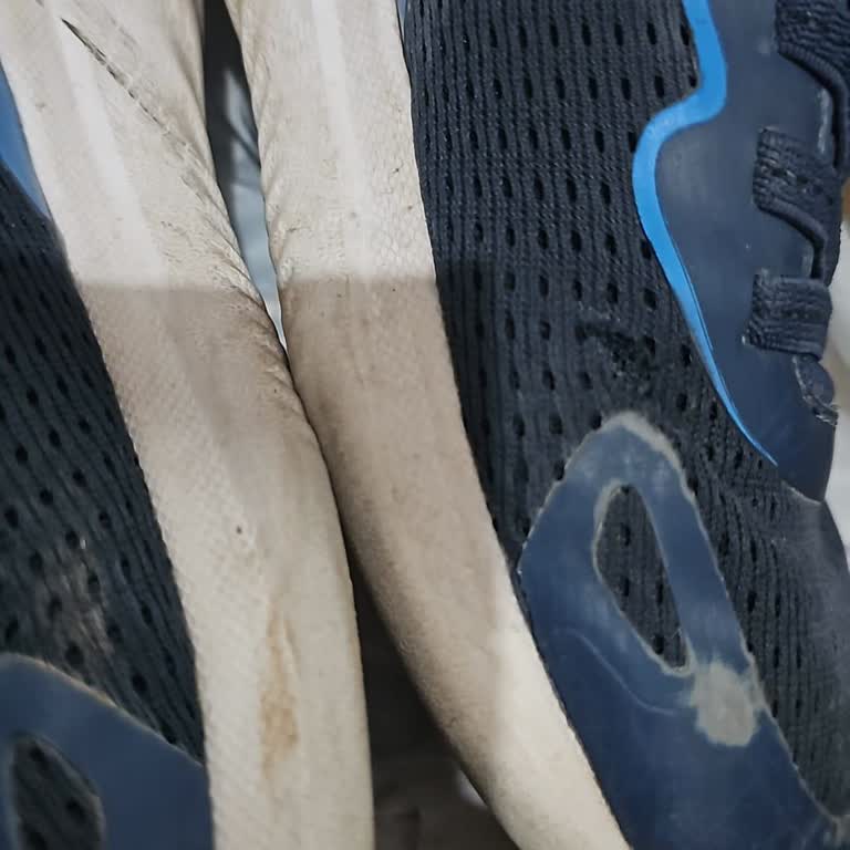 Skechers Ayakkabısının Üst Kısmı 3 Ayda Açıldı, Garanti Reddi Ve Değişim Talebi