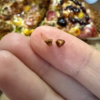 Pizza’da Taş Bulunması Diş Kırma Korkusu Ve Hijyen İhlali