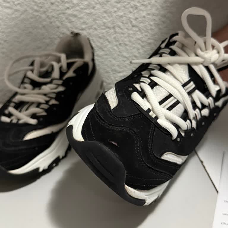 Skechers Ayakkabısının Kalitesizliği Ve Değişim Talebi