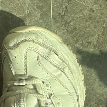 Skechers Ayakkabılarda Özensiz Bakım Sonrası Yırtık Ve Eksik İade Talebi