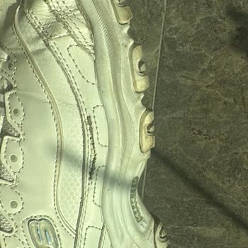 Skechers Ayakkabılarda Özensiz Bakım Sonrası Yırtık Ve Eksik İade Talebi