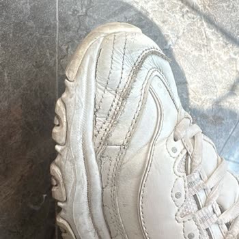 Skechers Ayakkabılarda Özensiz Bakım Sonrası Yırtık Ve Eksik İade Talebi