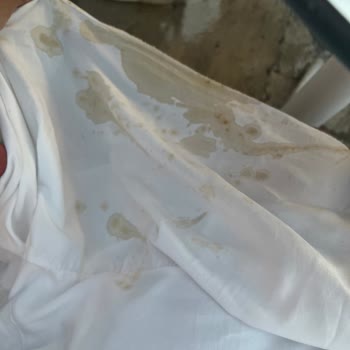 Kapak Hatası Nedeniyle Kahve Dökülmesi, Çifte Ücret Ve Çalışan İlgisizliği