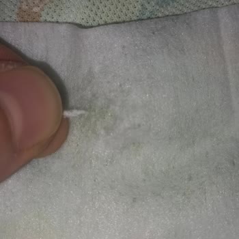 Bebek Mendilinde Sert Plastik Parçanın Keşfi