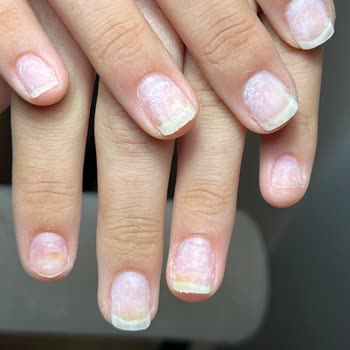 Bonita Nail Salonunda Protez Tırnak Sonrası Hava Alma Ve Mantar Sorunu İhmal Edildi