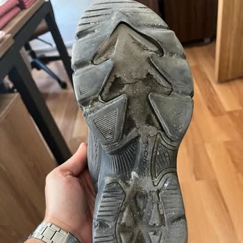 Yüksek Fiyatlı Skechers Ayakkabısının 10 Ayda Parçalanması Ve İade İsteği