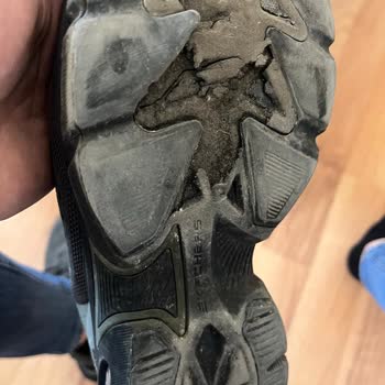 Yüksek Fiyatlı Skechers Ayakkabısının 10 Ayda Parçalanması Ve İade İsteği