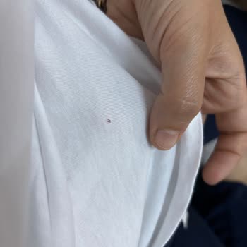 Mavi Basic Tişörtlerde Sürekli Delinme Sorunu, İade Ve Kalite Kontrol Talebi