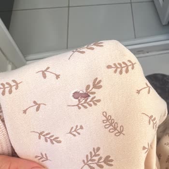 Arçelik Çamaşır Makinesinde Tekrarlayan Arızalar, Servis Reddi Ve Eksik Kayıtlar